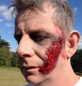 Scabby Face